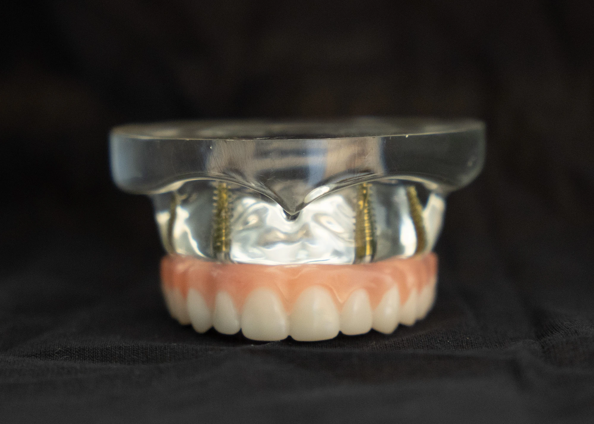 Fixed, full arch prosthesis sample.