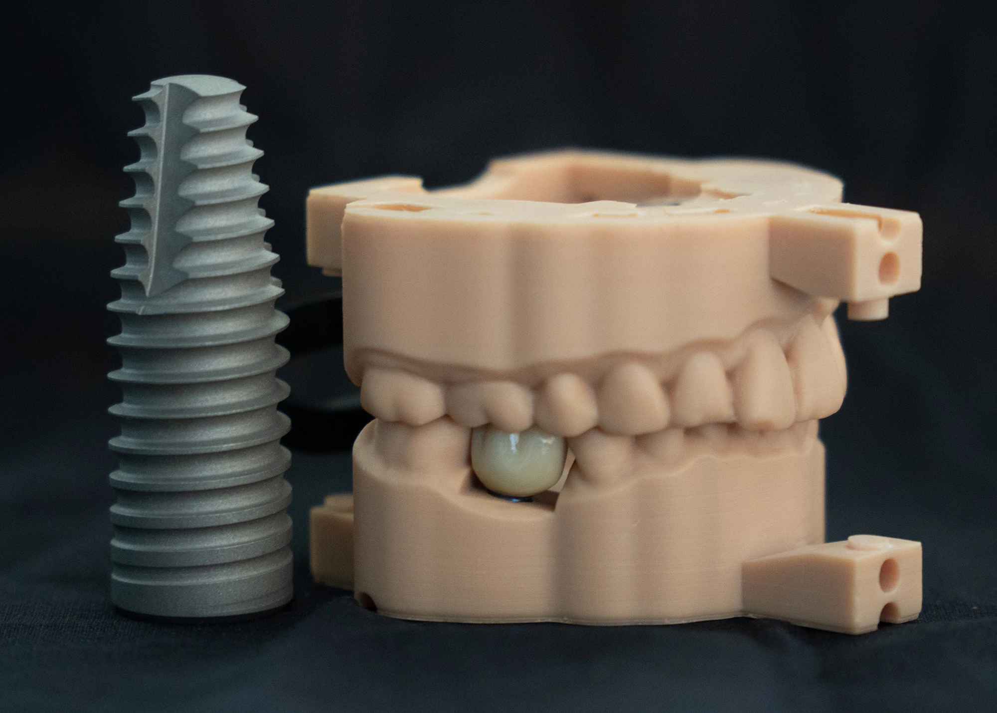 Single tooth dental implant